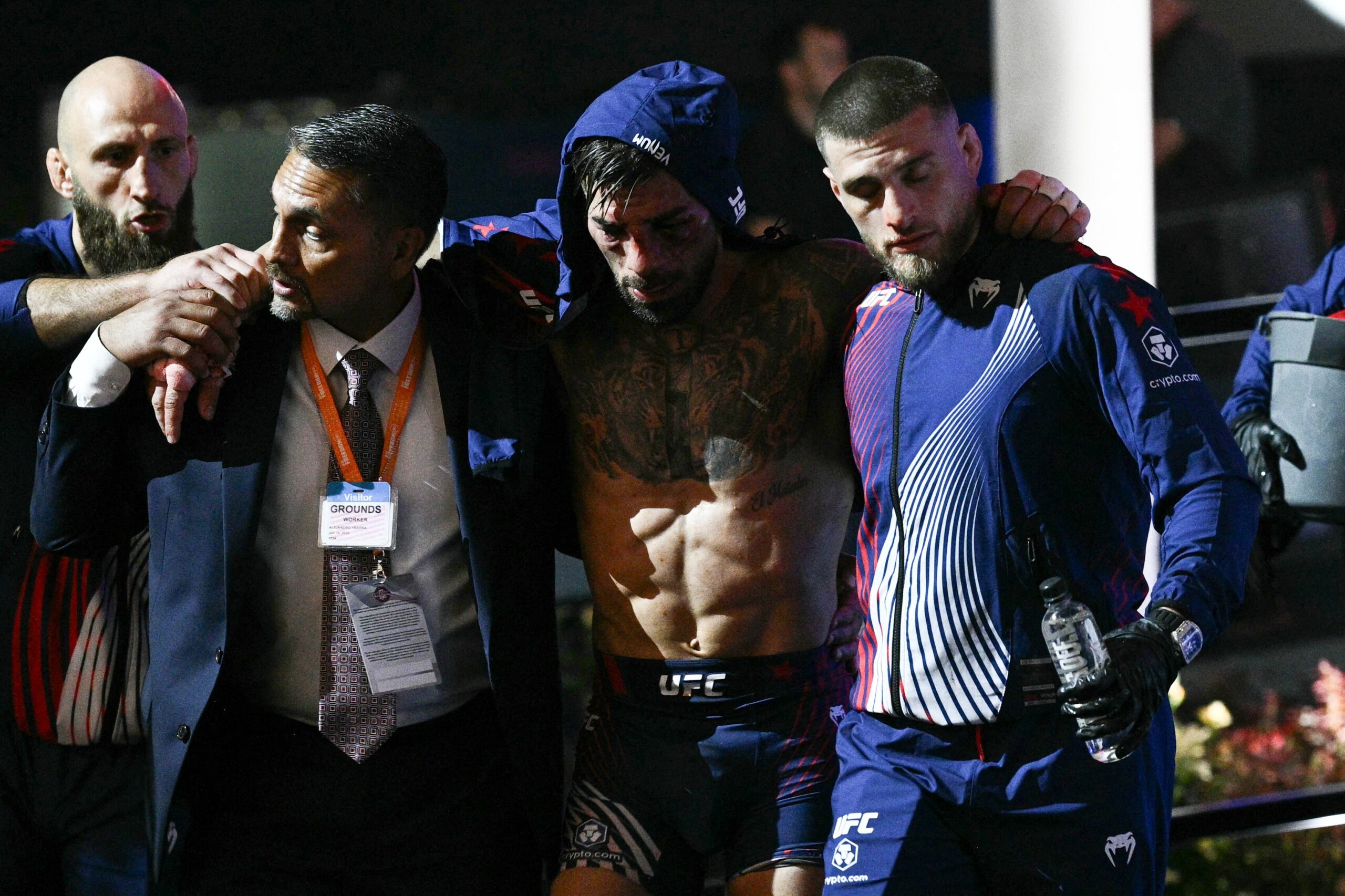 Ilia Topuria shares facial injury update after hiding UFC wounds for six weeks